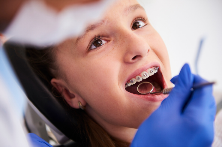 Braces