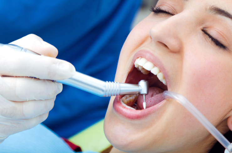 Extraction & Tooth Removal