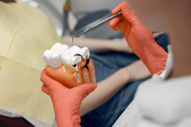 Root Canal Treatments